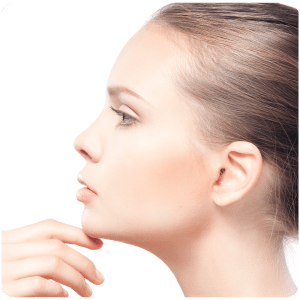Rinoplastia